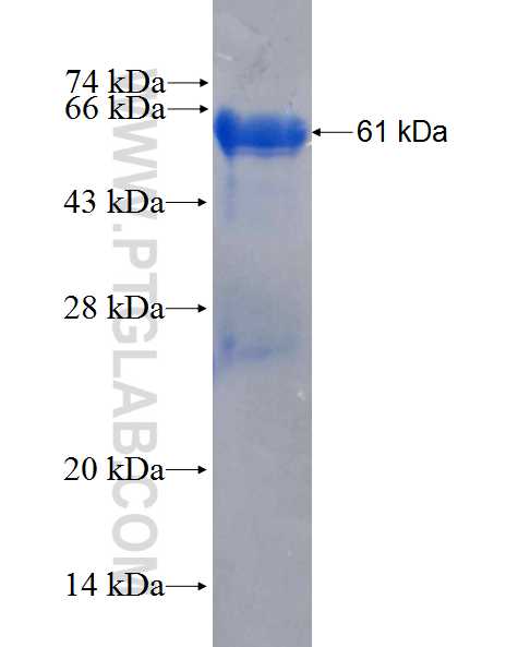 WBP2 fusion protein Ag2661 SDS-PAGE