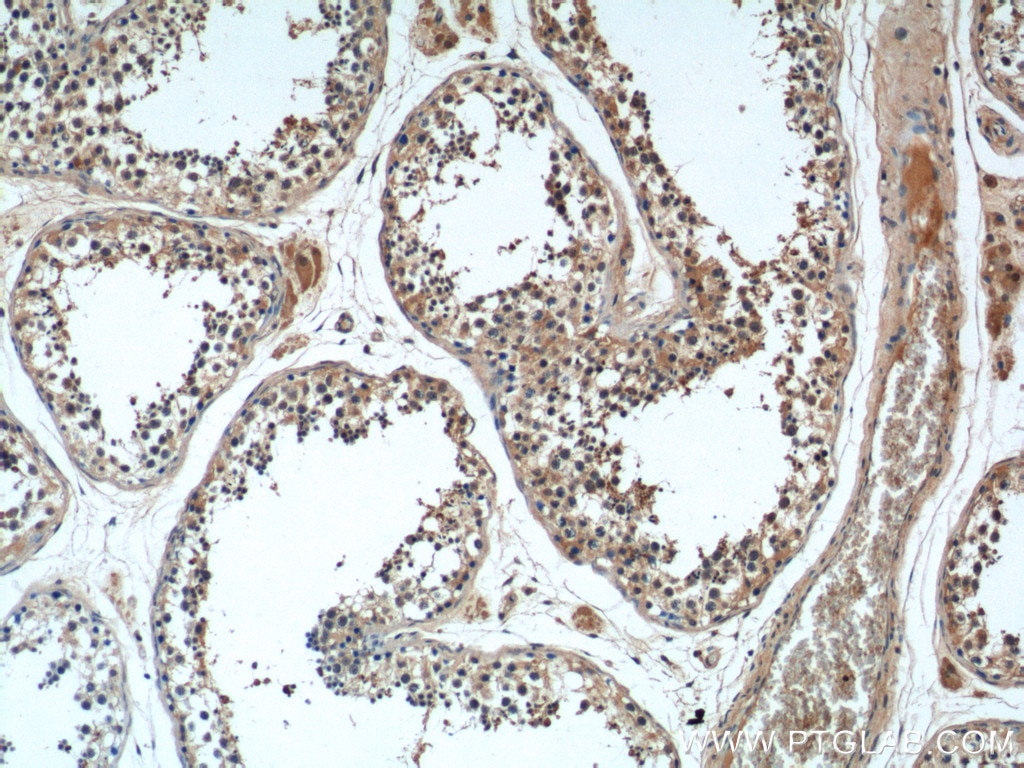 Immunohistochemistry (IHC) staining of human testis tissue using WBP2NL Polyclonal antibody (22587-1-AP)