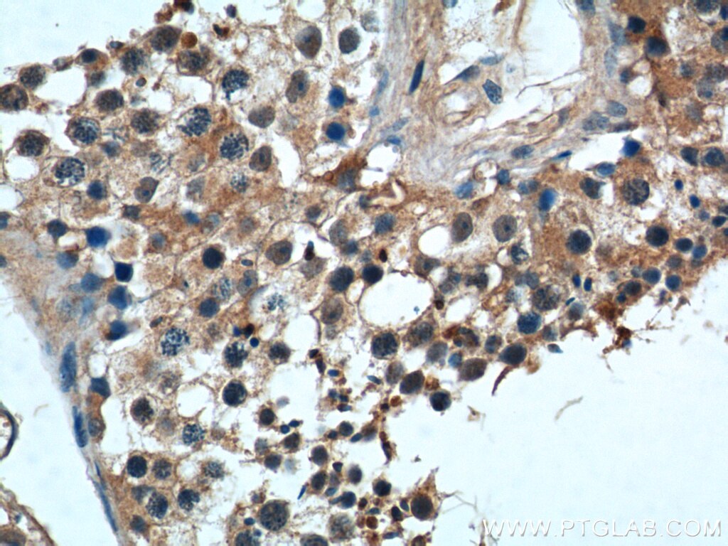 Immunohistochemistry (IHC) staining of human testis tissue using WBP2NL Polyclonal antibody (22587-1-AP)