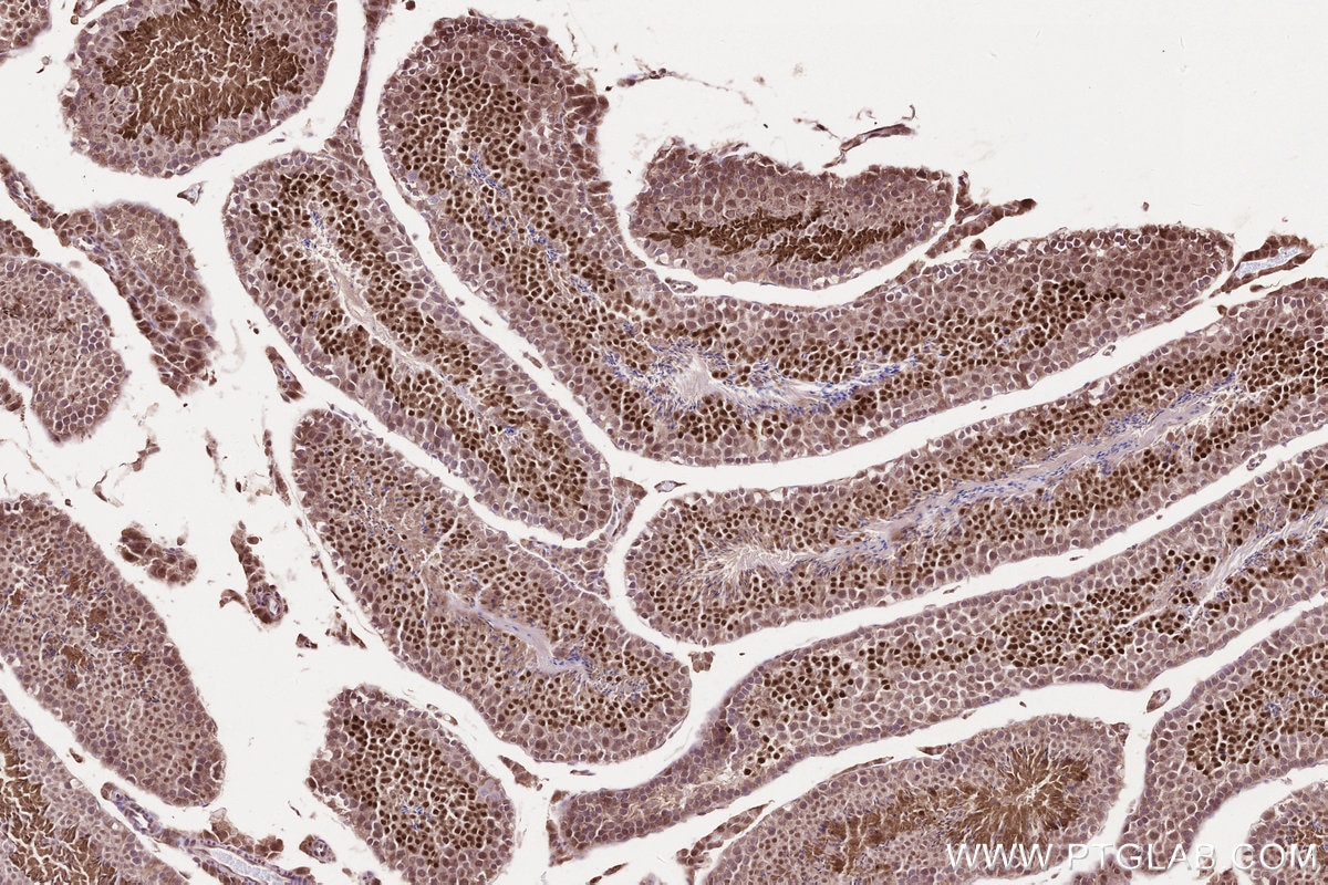 Immunohistochemistry (IHC) staining of mouse testis tissue using WBP2NL Polyclonal antibody (22587-1-AP)
