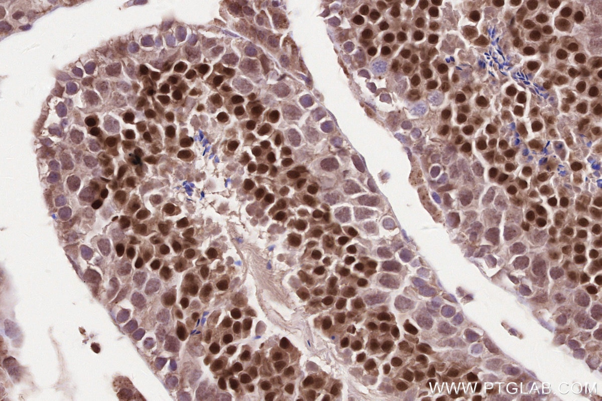 Immunohistochemistry (IHC) staining of mouse testis tissue using WBP2NL Polyclonal antibody (22587-1-AP)