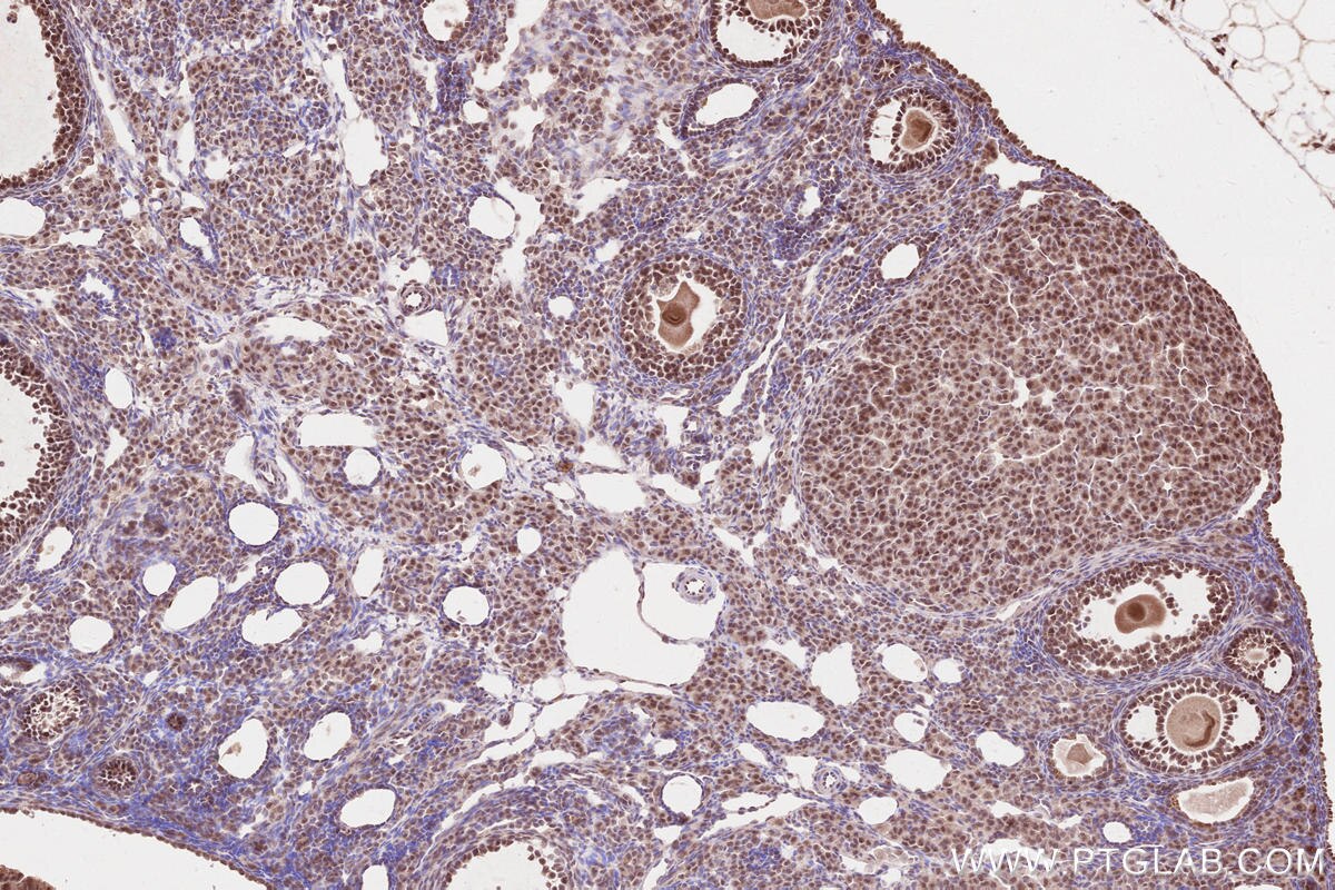 Immunohistochemistry (IHC) staining of mouse ovary tissue using WBP2NL Polyclonal antibody (22587-1-AP)