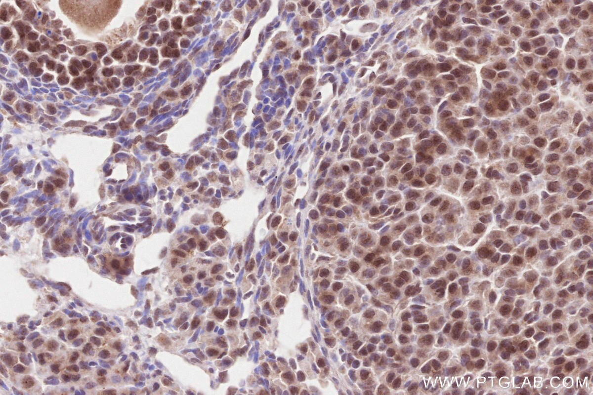 Immunohistochemistry (IHC) staining of mouse ovary tissue using WBP2NL Polyclonal antibody (22587-1-AP)