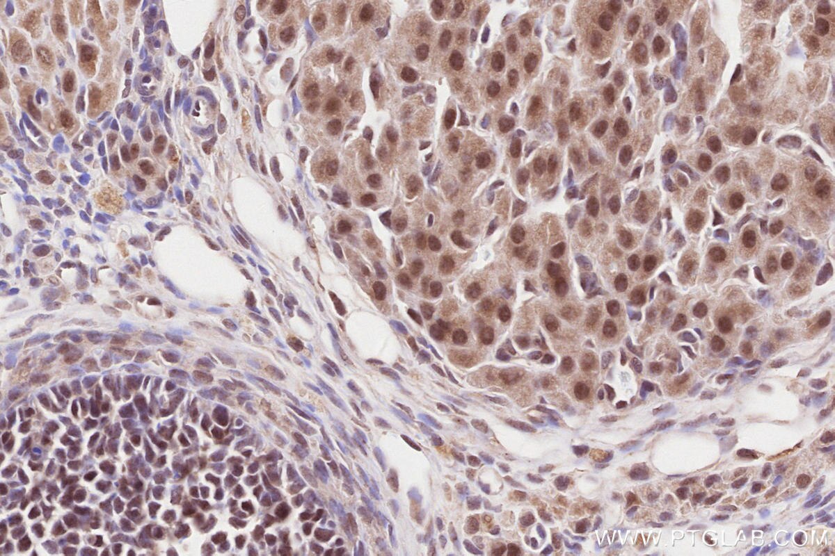 Immunohistochemistry (IHC) staining of rat ovary tissue using WBP2NL Polyclonal antibody (22587-1-AP)