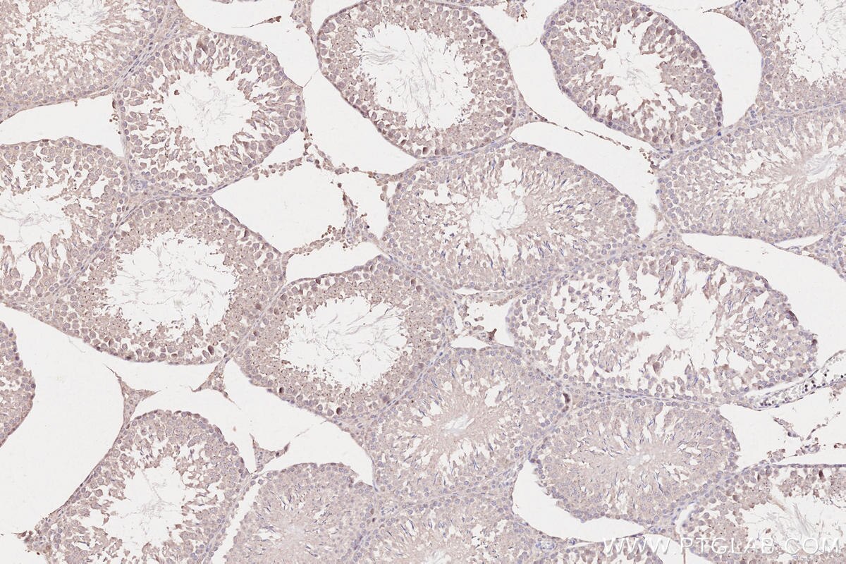 Immunohistochemistry (IHC) staining of rat testis tissue using WBP2NL Polyclonal antibody (22587-1-AP)