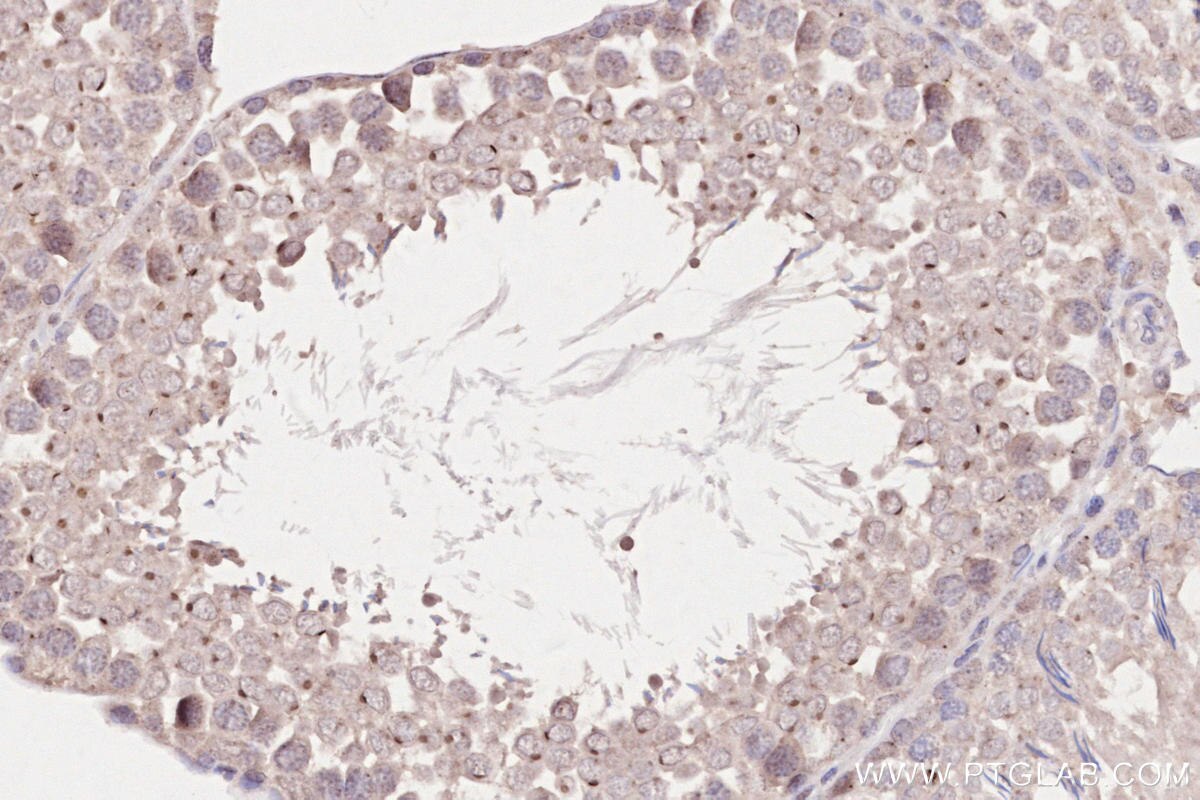 Immunohistochemistry (IHC) staining of rat testis tissue using WBP2NL Polyclonal antibody (22587-1-AP)