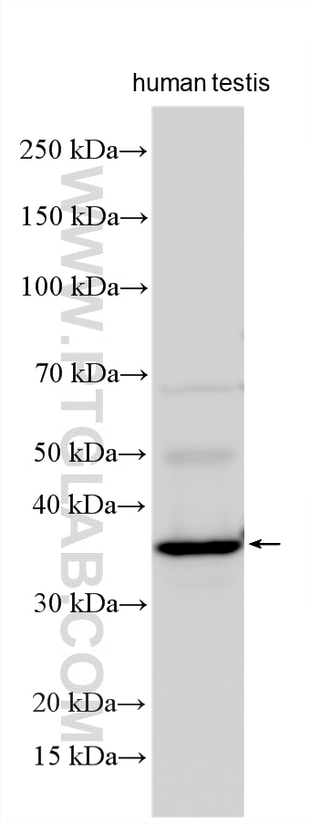 Western Blot (WB) analysis of various lysates using WBP2NL Polyclonal antibody (22587-1-AP)