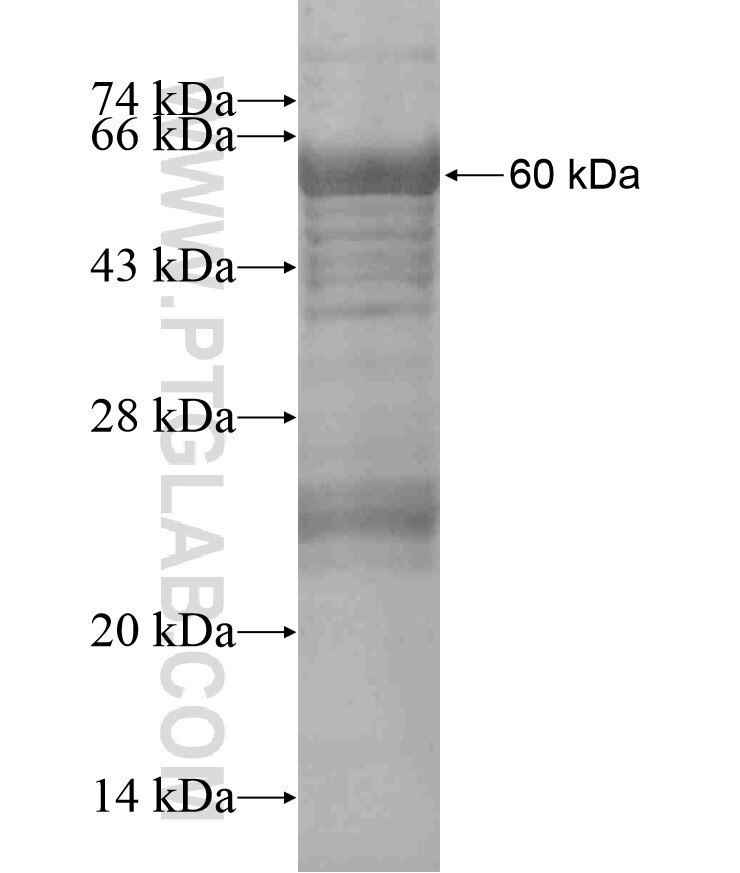 WBP2NL fusion protein Ag18293 SDS-PAGE