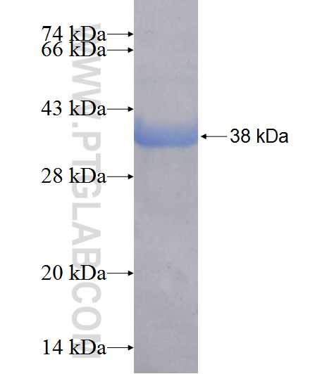 WBP2NL fusion protein Ag18347 SDS-PAGE