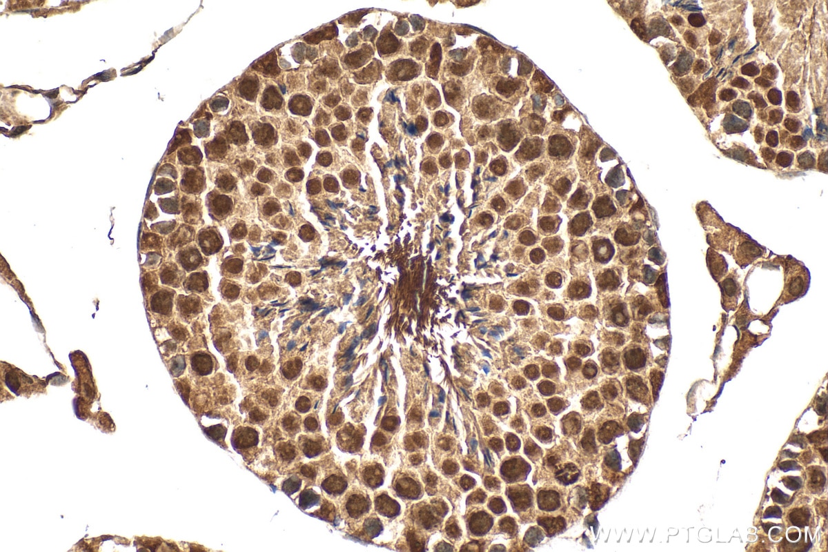 Immunohistochemistry (IHC) staining of mouse testis tissue using WBP4 Polyclonal antibody (32283-1-AP)