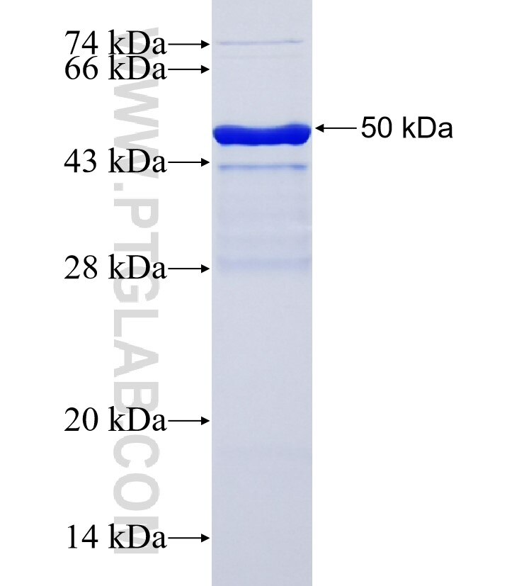 WBP4 fusion protein Ag35400 SDS-PAGE