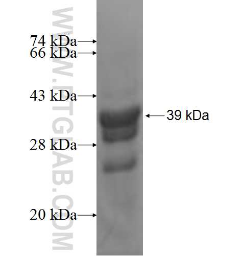 WBP5 fusion protein Ag9735 SDS-PAGE