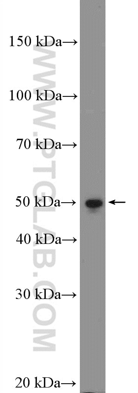 Western Blot (WB) analysis of HeLa cells using WBSCR16 Polyclonal antibody (13796-1-AP)