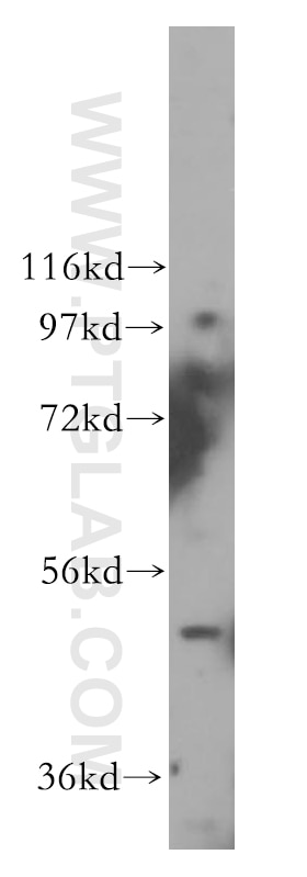 Western Blot (WB) analysis of Jurkat cells using WBSCR16 Polyclonal antibody (13796-1-AP)