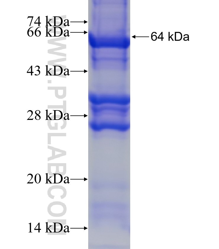 WBSCR16 fusion protein Ag4619 SDS-PAGE