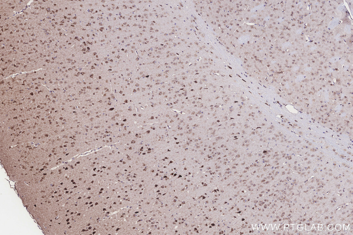 Immunohistochemistry (IHC) staining of mouse brain tissue using WBSCR17 Polyclonal antibody (21280-1-AP)