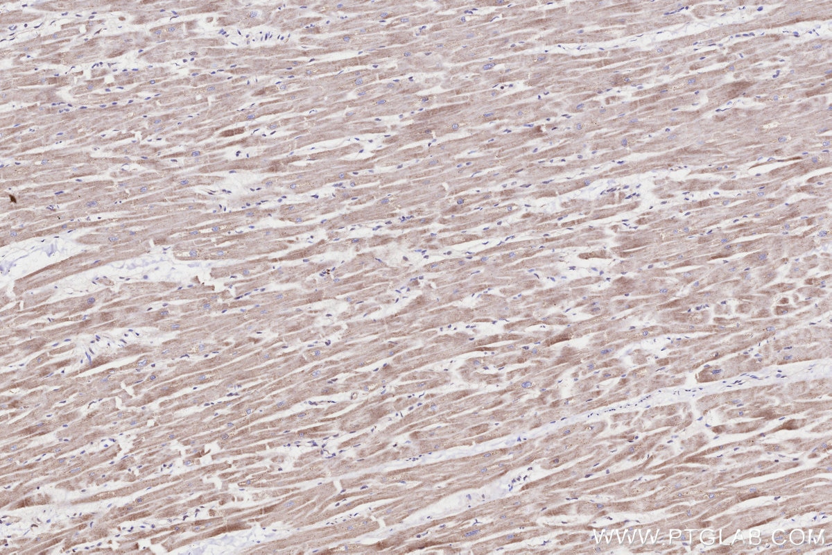 Immunohistochemistry (IHC) staining of human heart tissue using WBSCR17 Polyclonal antibody (21280-1-AP)
