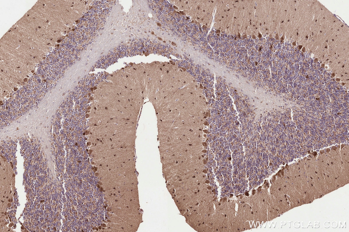 Immunohistochemistry (IHC) staining of mouse cerebellum tissue using WBSCR17 Polyclonal antibody (21280-1-AP)