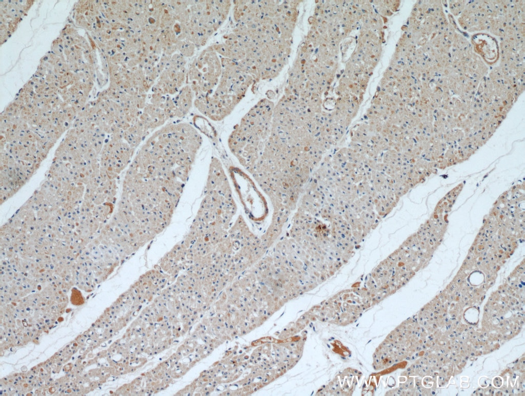 Immunohistochemistry (IHC) staining of human heart tissue using WBSCR17 Polyclonal antibody (21280-1-AP)