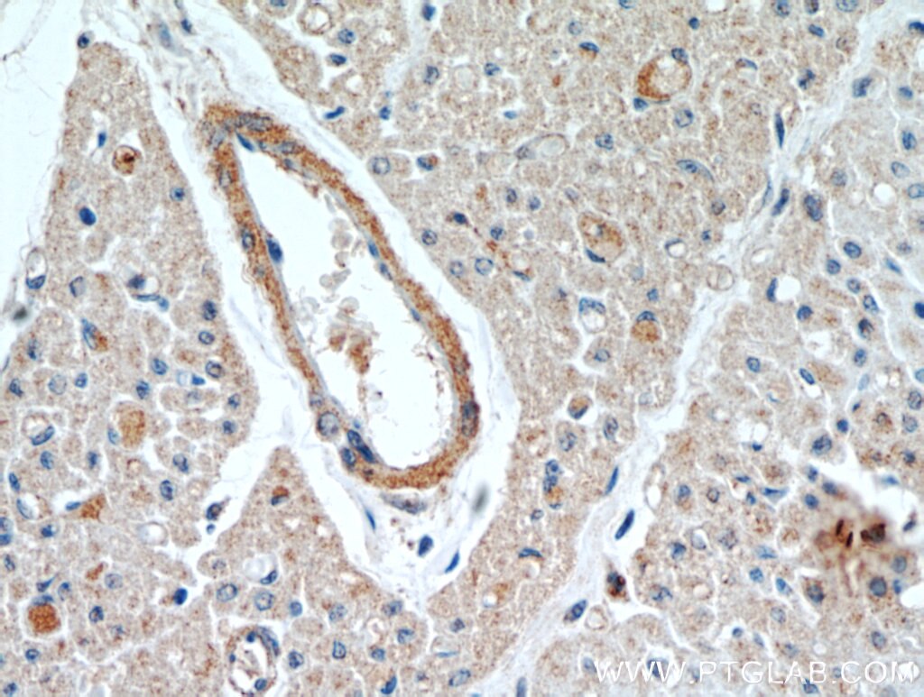 Immunohistochemistry (IHC) staining of human heart tissue using WBSCR17 Polyclonal antibody (21280-1-AP)