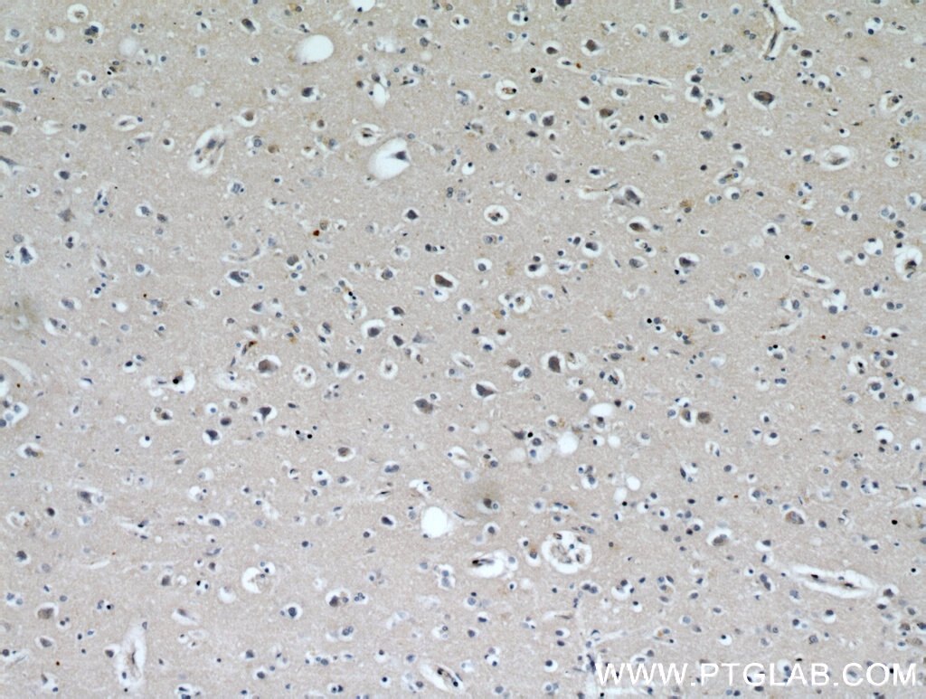 Immunohistochemistry (IHC) staining of human brain tissue using WBSCR17 Polyclonal antibody (21280-1-AP)