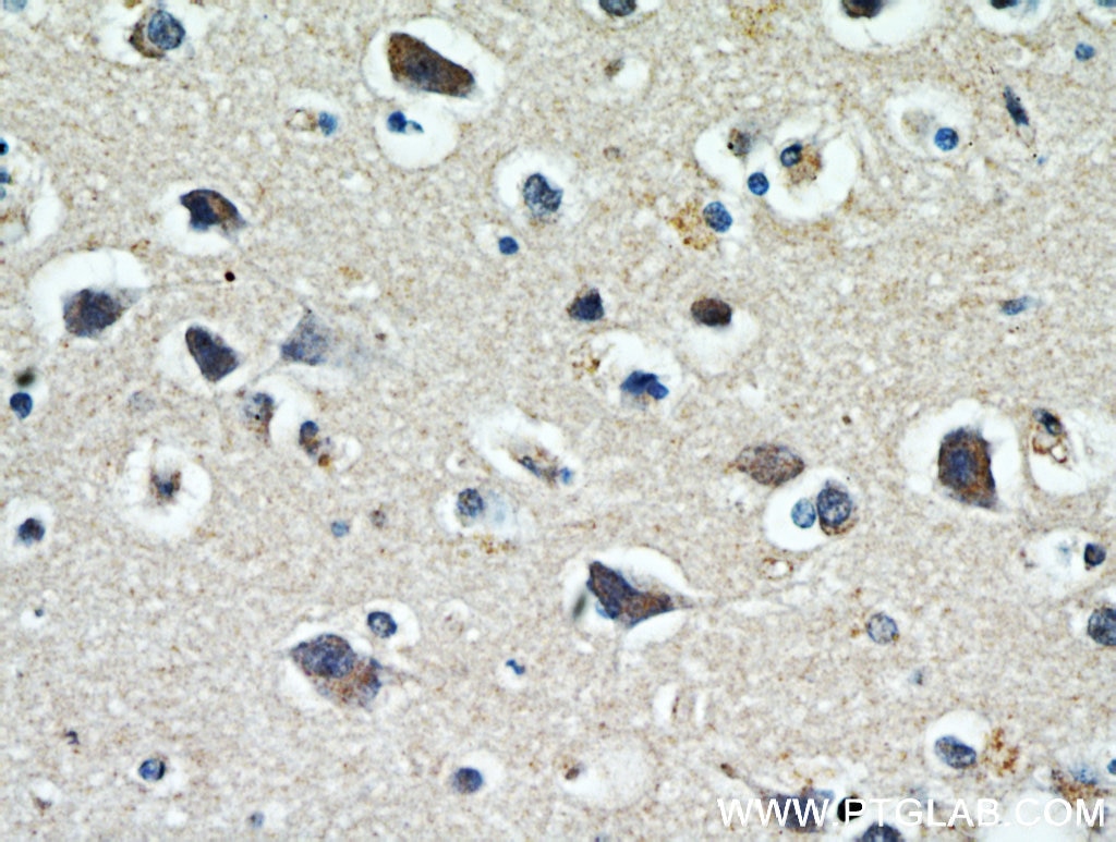 Immunohistochemistry (IHC) staining of human brain tissue using WBSCR17 Polyclonal antibody (21280-1-AP)