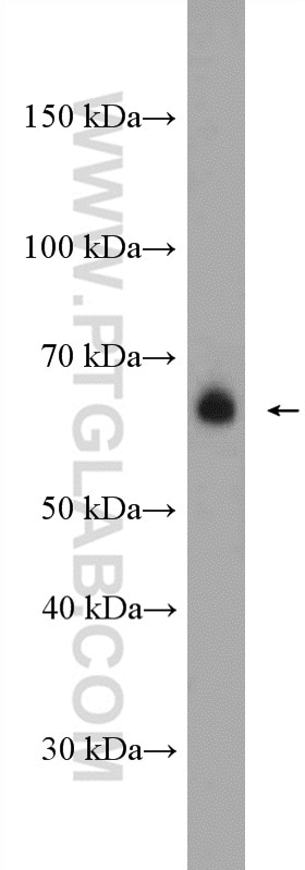 Western Blot (WB) analysis of A549 cells using WBSCR17 Polyclonal antibody (21280-1-AP)