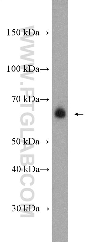 Western Blot (WB) analysis of A549 cells using WBSCR17 Polyclonal antibody (21280-1-AP)