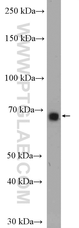 Western Blot (WB) analysis of mouse brain tissue using WBSCR17 Polyclonal antibody (21280-1-AP)