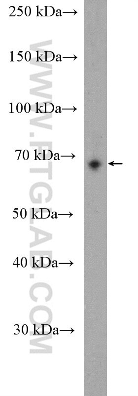 Western Blot (WB) analysis of mouse lung tissue using WBSCR17 Polyclonal antibody (21280-1-AP)