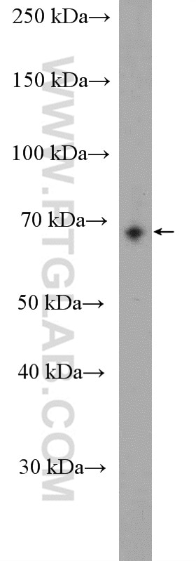 WB analysis of mouse lung using 21280-1-AP