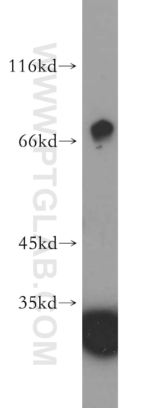 Western Blot (WB) analysis of human brain tissue using WBSCR17 Polyclonal antibody (21280-1-AP)