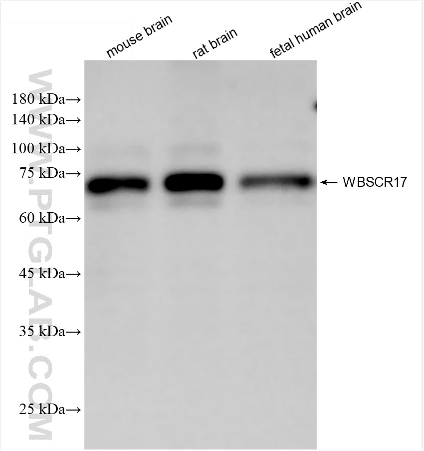 Western Blot (WB) analysis of various lysates using WBSCR17 Recombinant antibody (86351-1-RR)