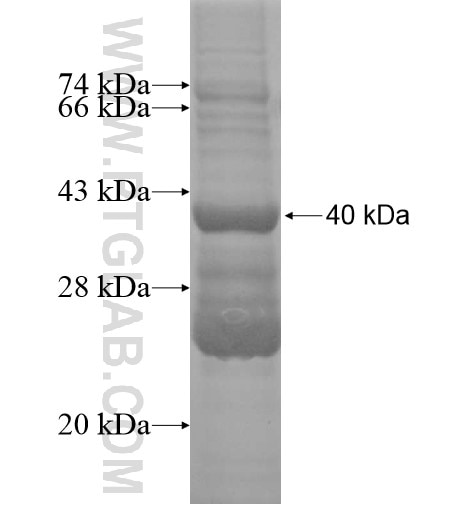 WBSCR17 fusion protein Ag15792 SDS-PAGE