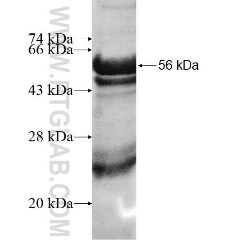 WBSCR27 fusion protein Ag4256 SDS-PAGE