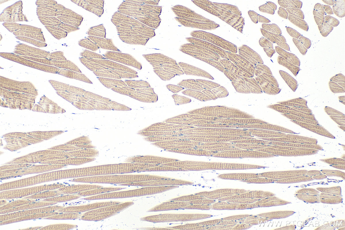 Immunohistochemistry (IHC) staining of mouse skeletal muscle tissue using WDCP Polyclonal antibody (28629-1-AP)