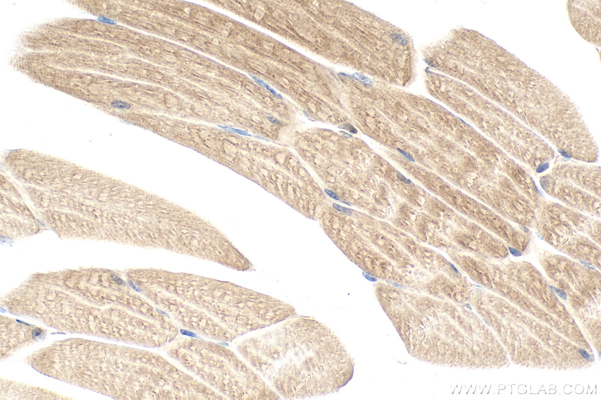 Immunohistochemistry (IHC) staining of mouse skeletal muscle tissue using WDCP Polyclonal antibody (28629-1-AP)