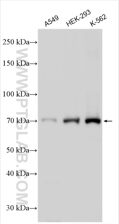 Western Blot (WB) analysis of various lysates using WDCP Polyclonal antibody (28629-1-AP)