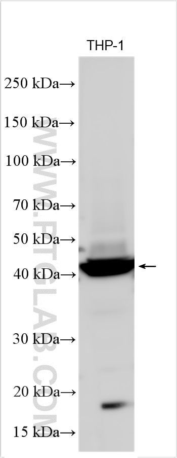 Western Blot (WB) analysis of various lysates using WDFY1 Polyclonal antibody (13960-1-AP)