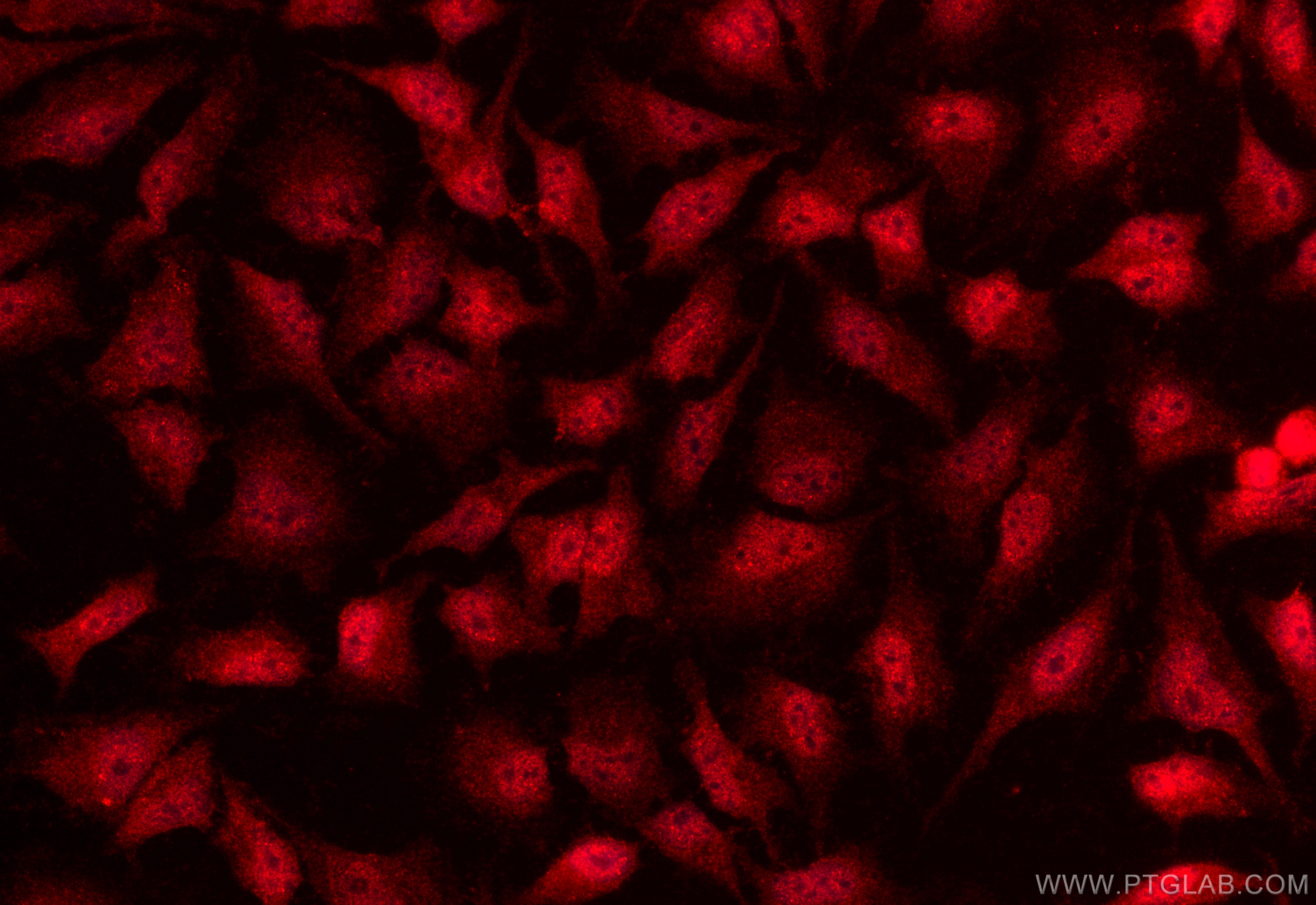 Immunofluorescent analysis of (-20°C Ethanol) fixed HeLa cells using WDFY2 antibody (17197-1-AP) at dilution of 1:200 and CoraLite®594-Conjugated Goat Anti-Rabbit IgG(H+L) (SA00013-4). Immunofluorescence (IF) / fluorescent staining of HeLa cells using WDFY2 Polyclonal antibody (17197-1-AP)
