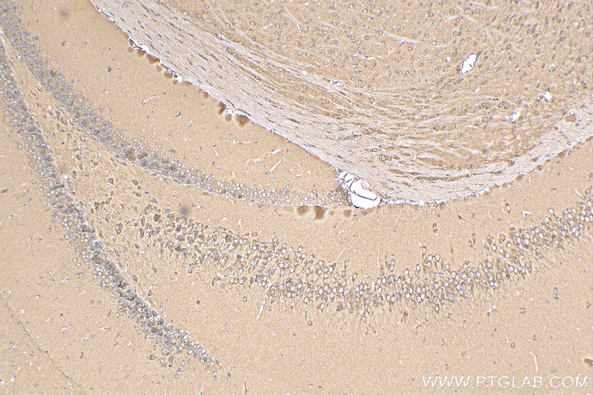 Immunohistochemistry (IHC) staining of mouse brain tissue using WDFY3 Polyclonal antibody (55009-1-AP)