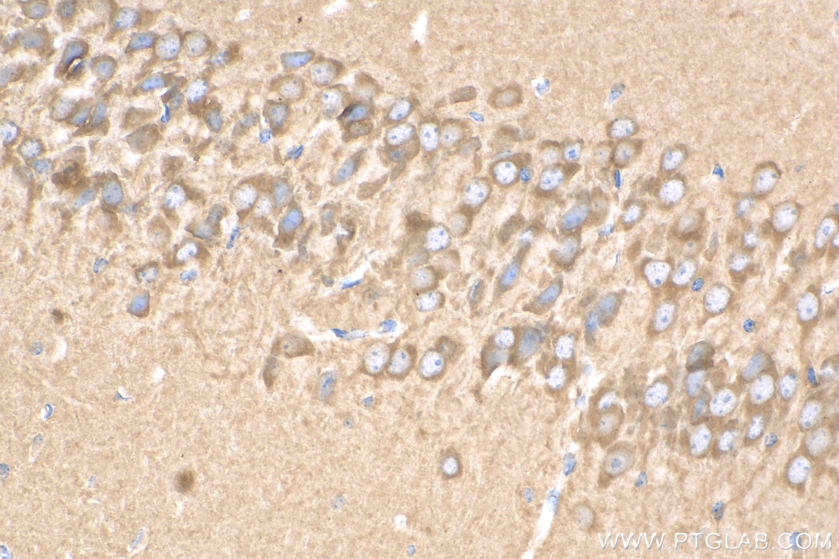 IHC staining of mouse brain using 55009-1-AP