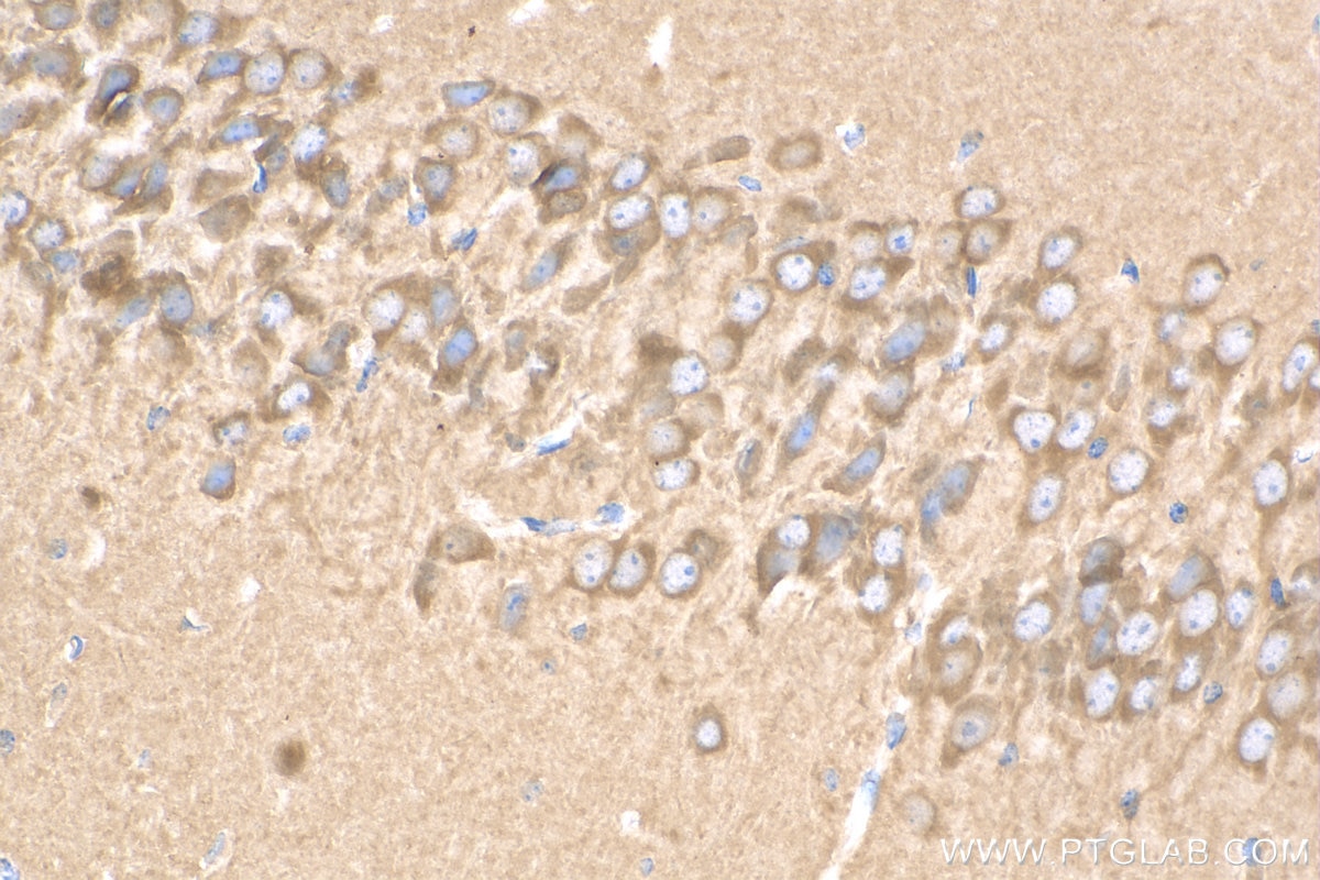 Immunohistochemistry (IHC) staining of mouse brain tissue using WDFY3 Polyclonal antibody (55009-1-AP)