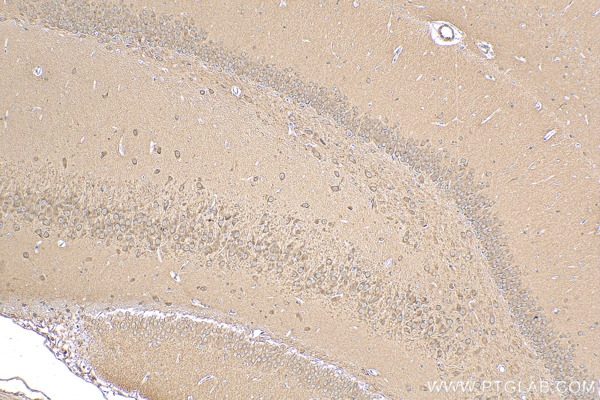 Immunohistochemistry (IHC) staining of rat brain tissue using WDFY3 Polyclonal antibody (55009-1-AP)