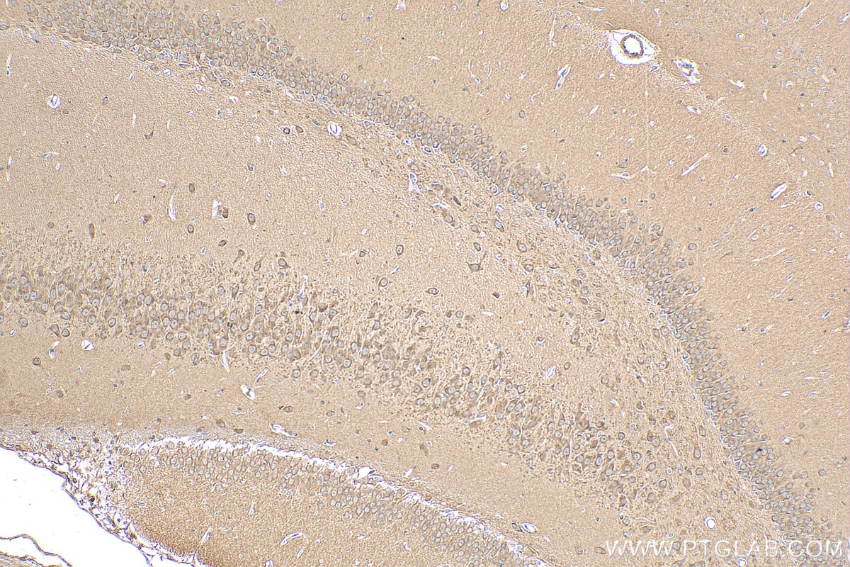 IHC staining of rat brain using 55009-1-AP