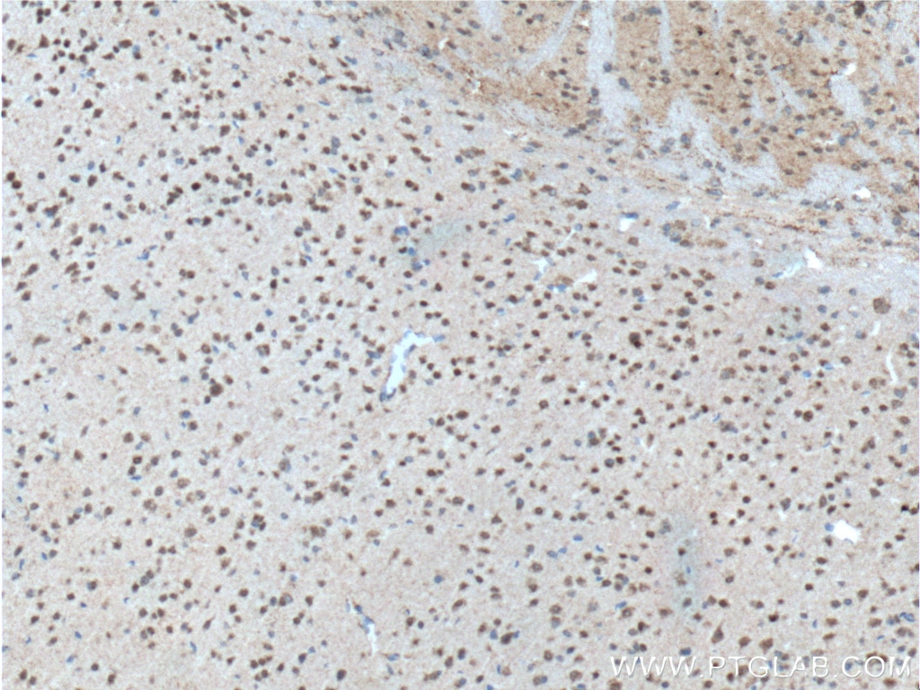 Immunohistochemistry (IHC) staining of mouse brain tissue using WDFY3 Polyclonal antibody (55009-1-AP)