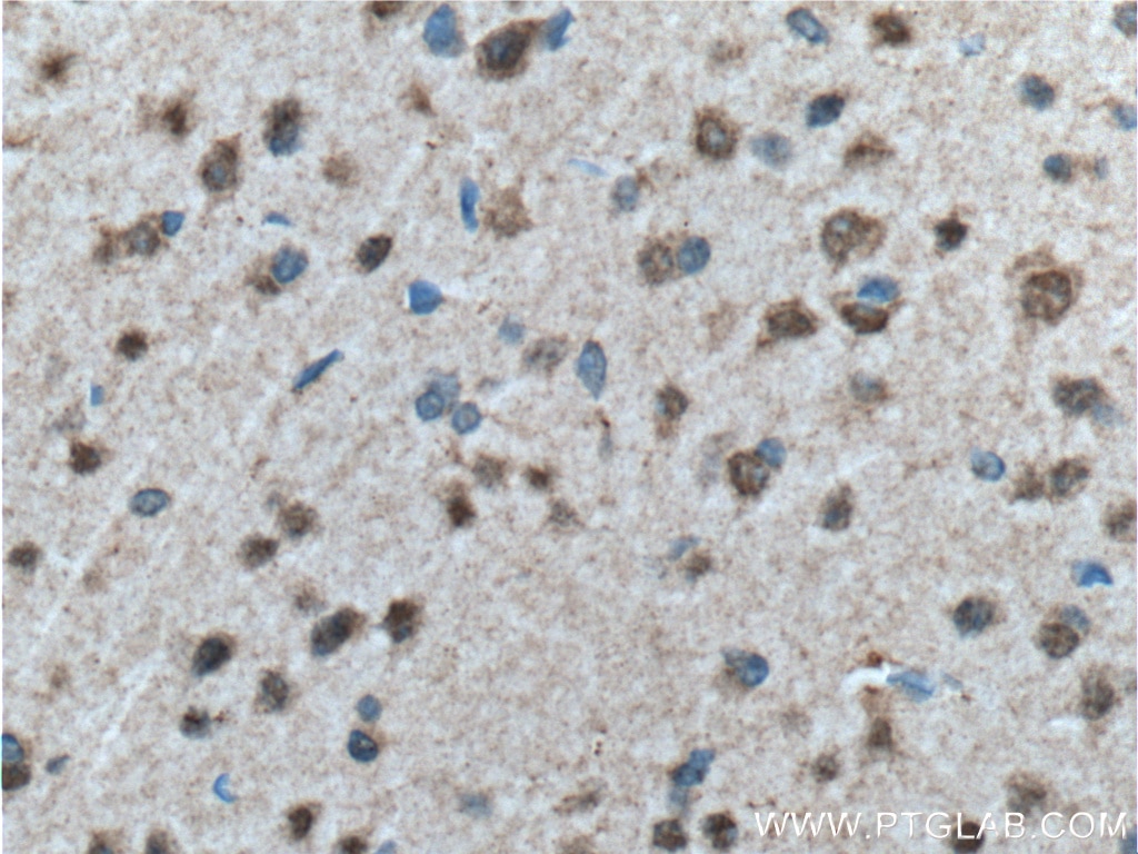 Immunohistochemistry (IHC) staining of mouse brain tissue using WDFY3 Polyclonal antibody (55009-1-AP)
