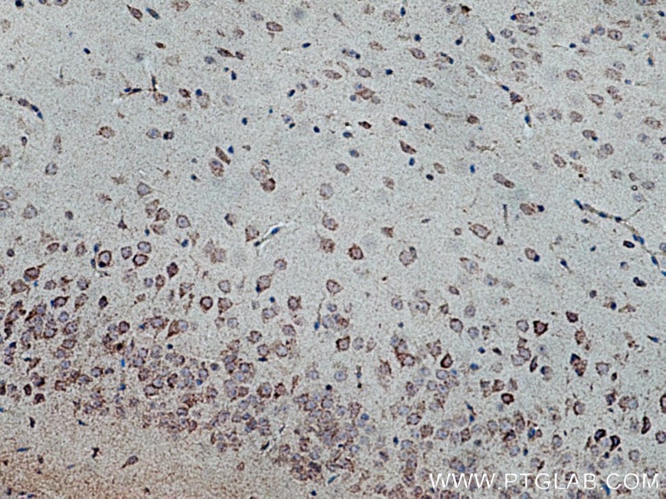 Immunohistochemistry (IHC) staining of mouse brain tissue using WDFY4 Polyclonal antibody (17558-1-AP)