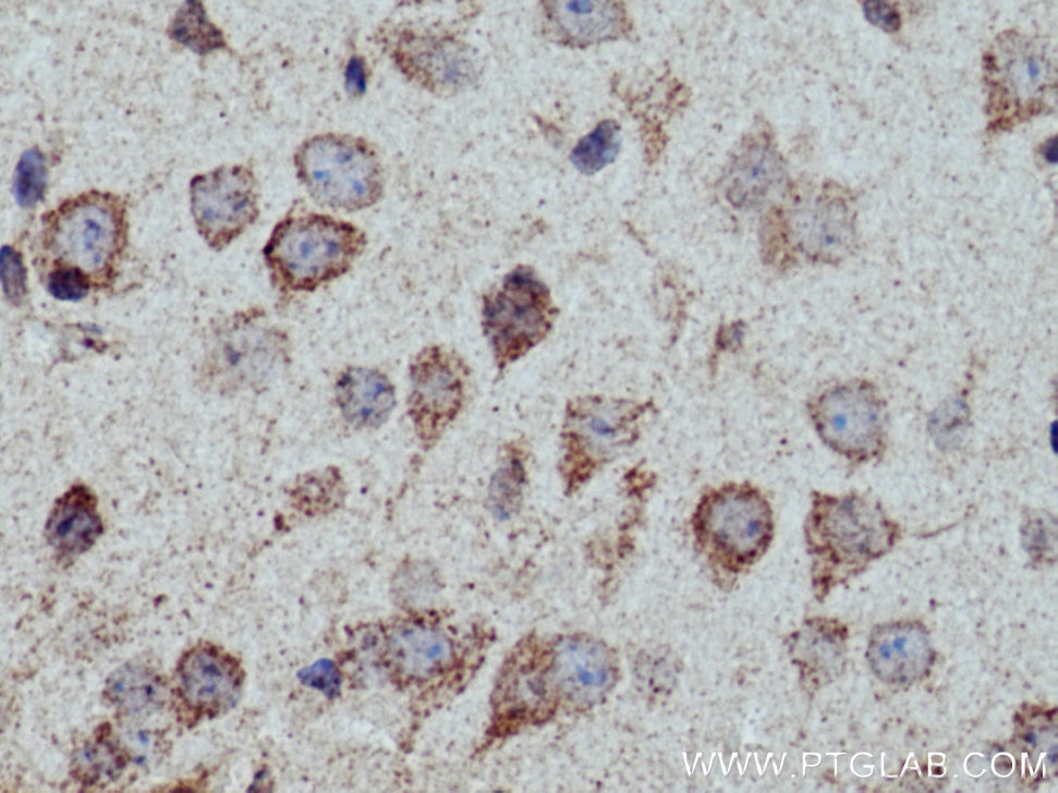 Immunohistochemistry (IHC) staining of mouse brain tissue using WDFY4 Polyclonal antibody (17558-1-AP)