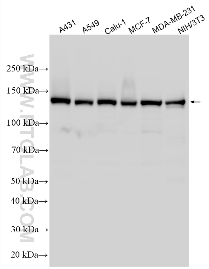 Western Blot (WB) analysis of various lysates using WDHD1 Polyclonal antibody (33739-1-AP)